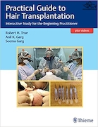 Practical Guide to Hair Transplantation | راهنمای عملی کاشت مو
